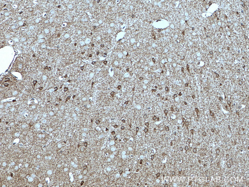 Immunohistochemistry (IHC) staining of mouse brain tissue using GAD65 Polyclonal antibody (21760-1-AP)