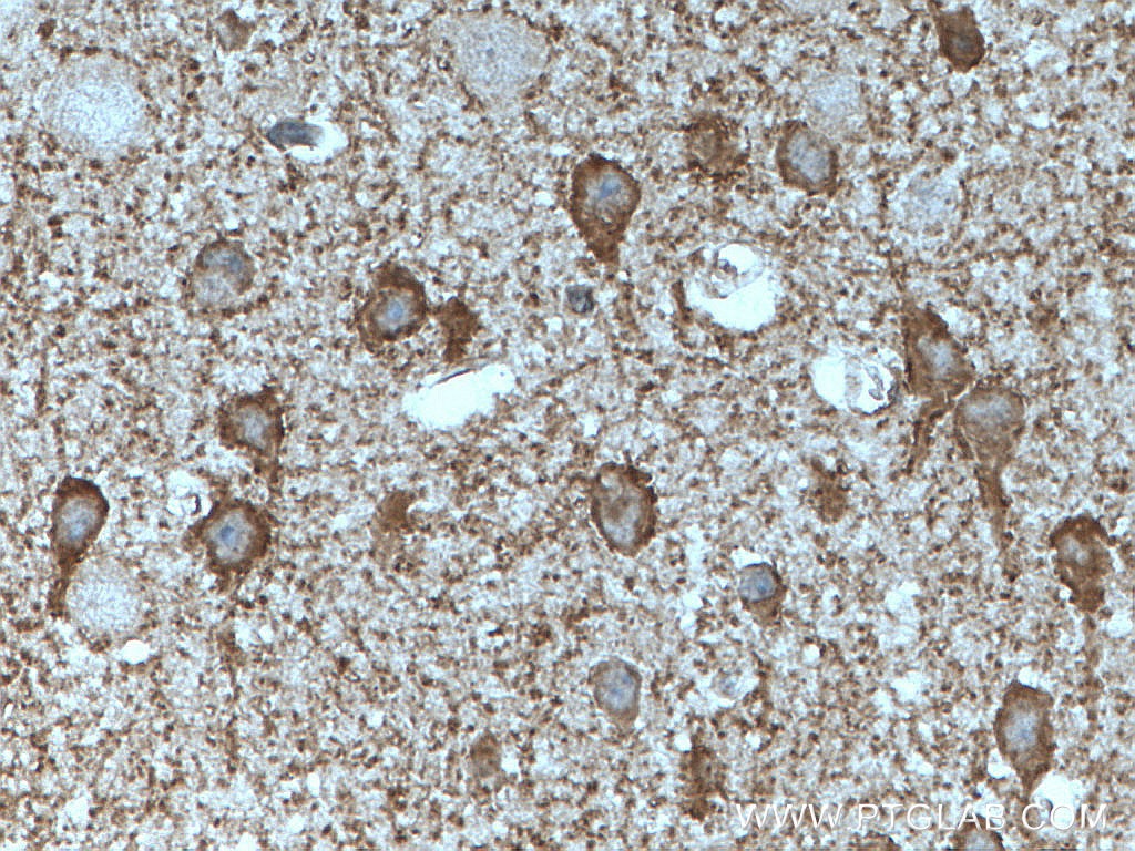 Immunohistochemistry (IHC) staining of mouse brain tissue using GAD65 Polyclonal antibody (21760-1-AP)