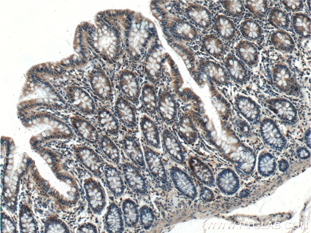 IHC staining of human colon using 21760-1-AP