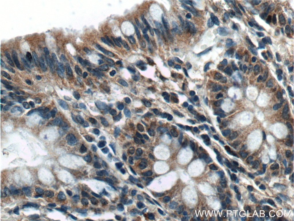 Immunohistochemistry (IHC) staining of human colon tissue using GAD65 Polyclonal antibody (21760-1-AP)