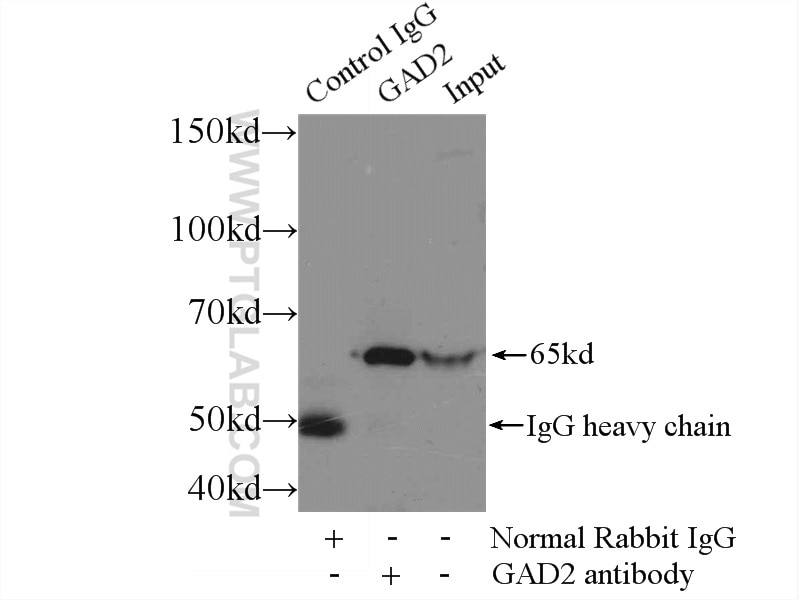 Immunoprecipitation (IP) experiment of rat brain tissue using GAD65 Polyclonal antibody (21760-1-AP)