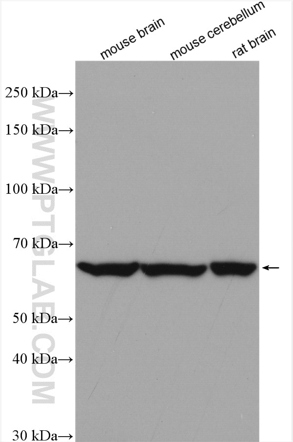 Western Blot (WB) analysis of various lysates using GAD65 Polyclonal antibody (21760-1-AP)
