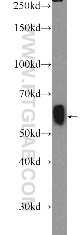 Western Blot (WB) analysis of mouse brain tissue using GAD65 Polyclonal antibody (21760-1-AP)