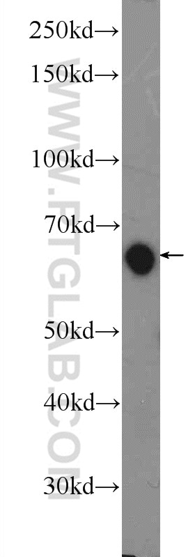 WB analysis of rat brain using 21760-1-AP