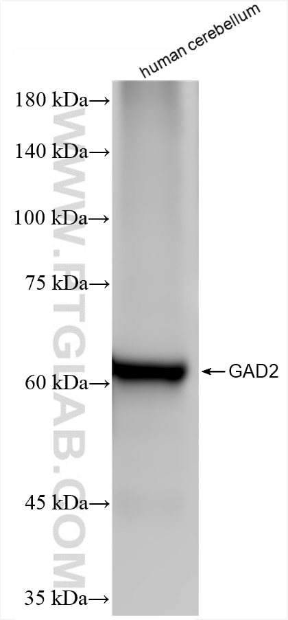 GAD65