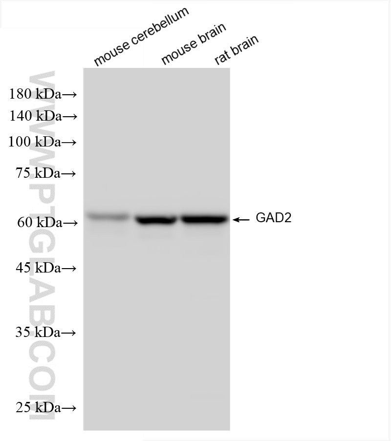 Western Blot (WB) analysis of various lysates using GAD65 Recombinant antibody (85750-1-RR)