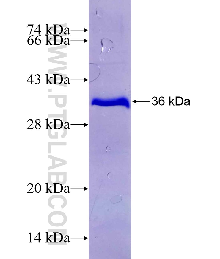 GAD2 fusion protein Ag29472 SDS-PAGE