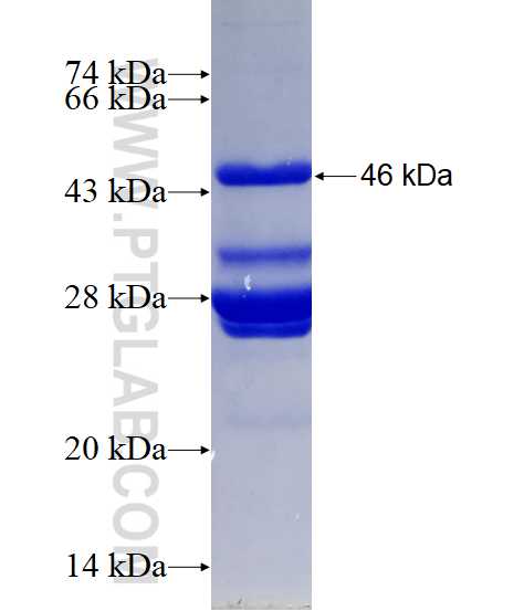 GAD2 fusion protein Ag16251 SDS-PAGE