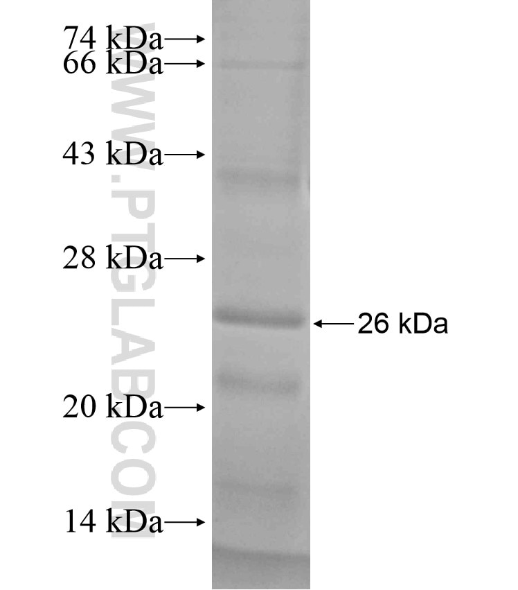 GAD2 fusion protein Ag17721 SDS-PAGE