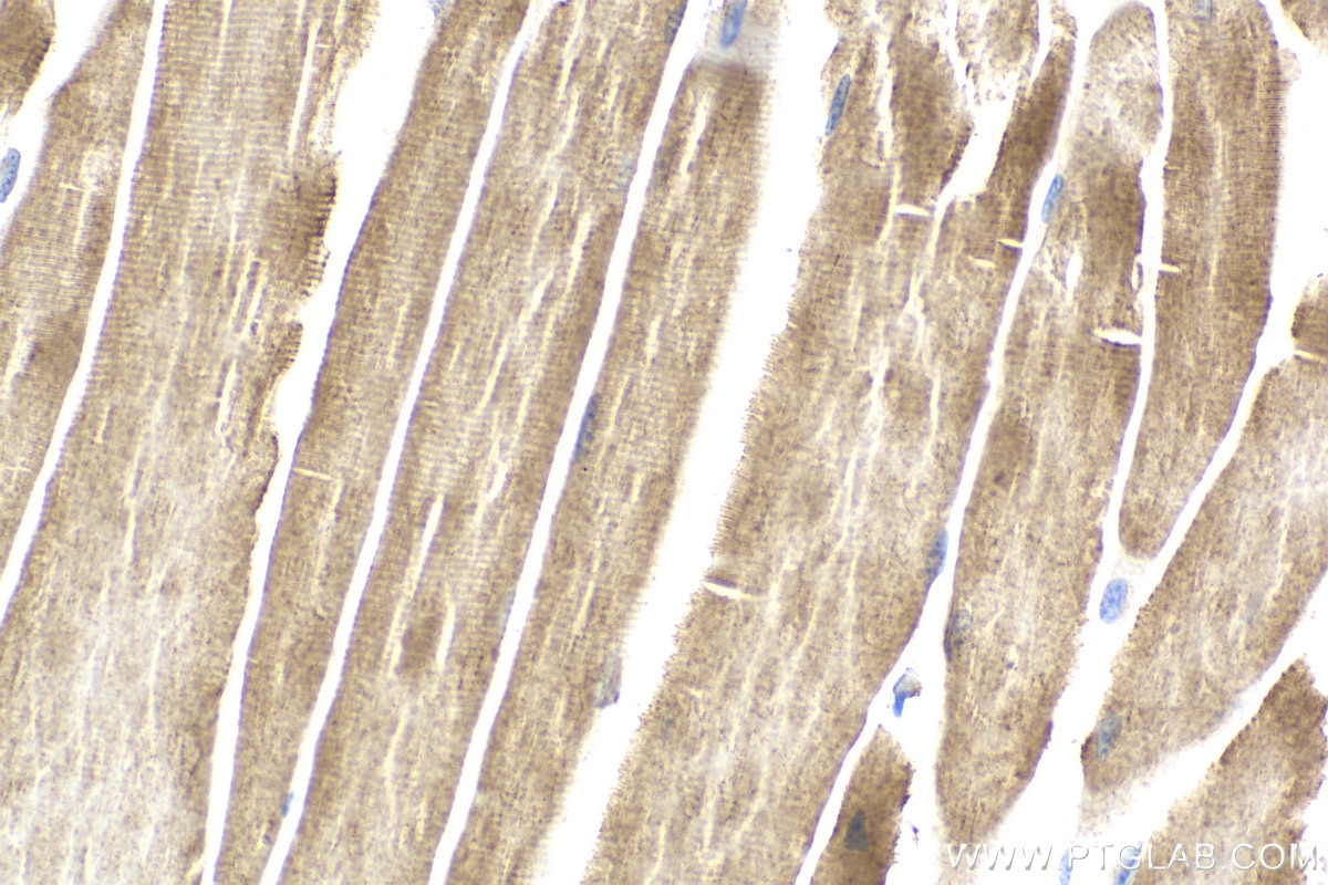 Immunohistochemistry (IHC) staining of mouse skeletal muscle tissue using GADD34 Recombinant monoclonal antibody (81250-1-RR)