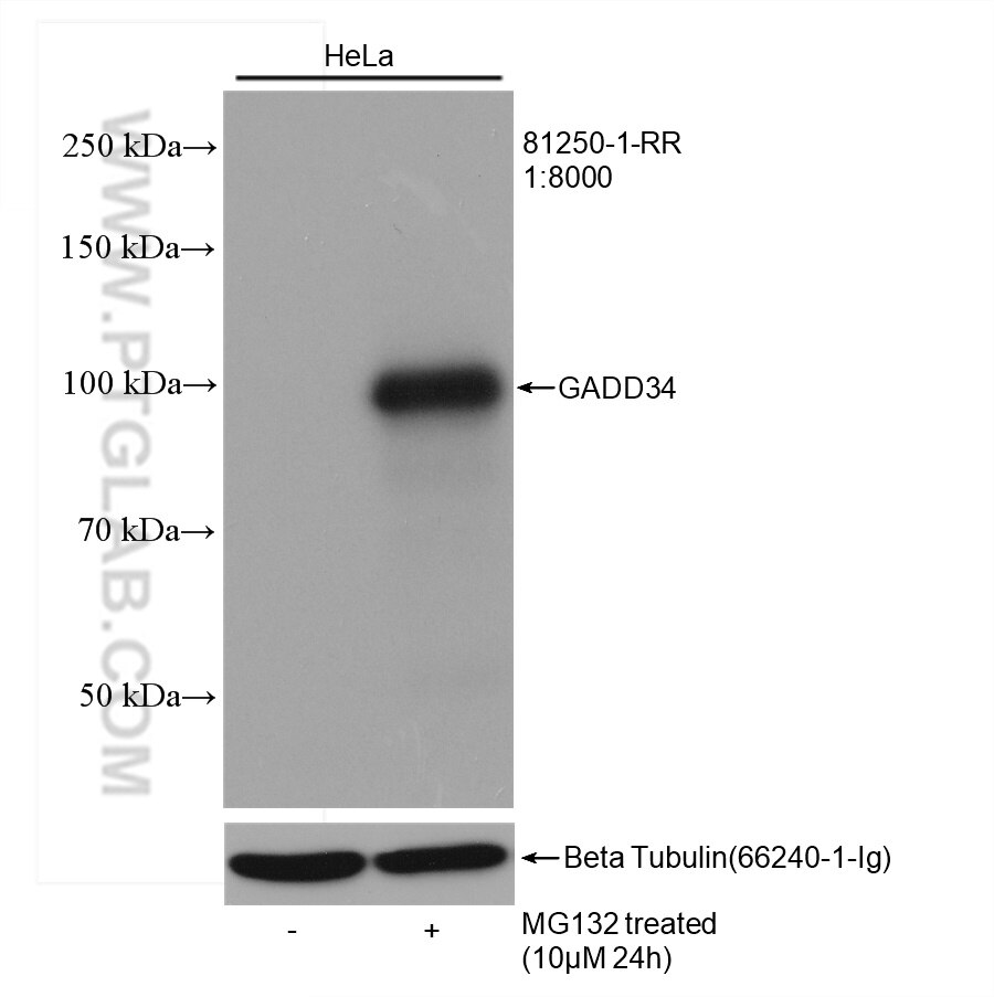 Western Blot (WB) analysis of HeLa cells using GADD34 Recombinant antibody (81250-1-RR)