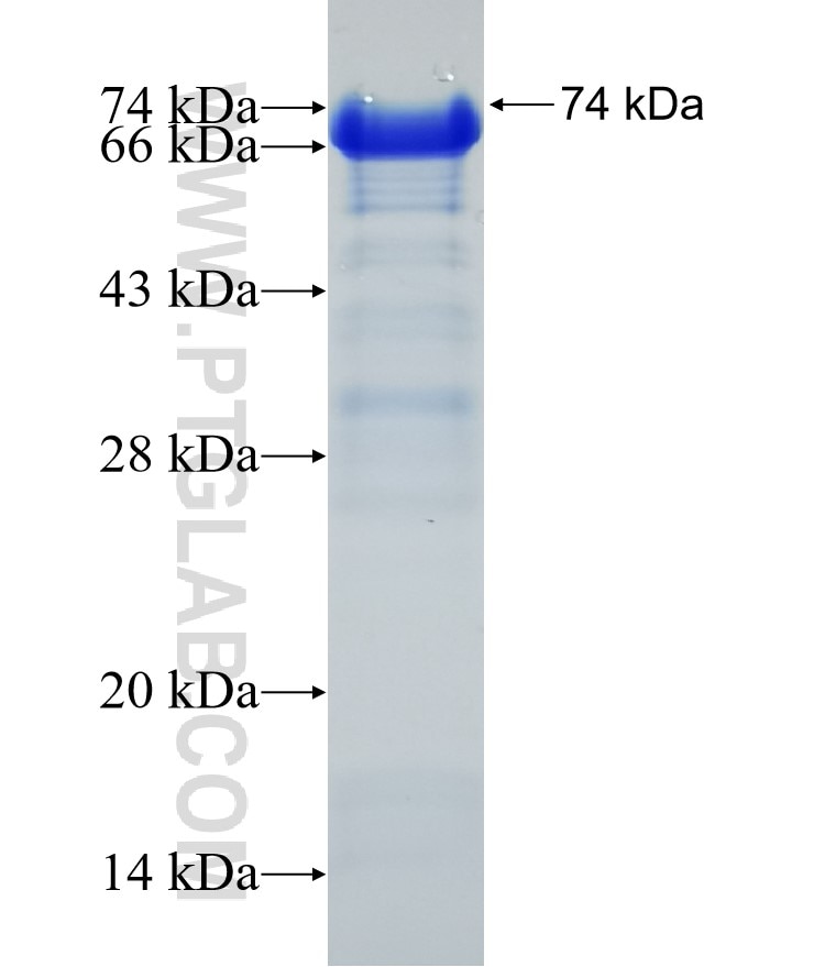 GADD34 fusion protein Ag0578 SDS-PAGE