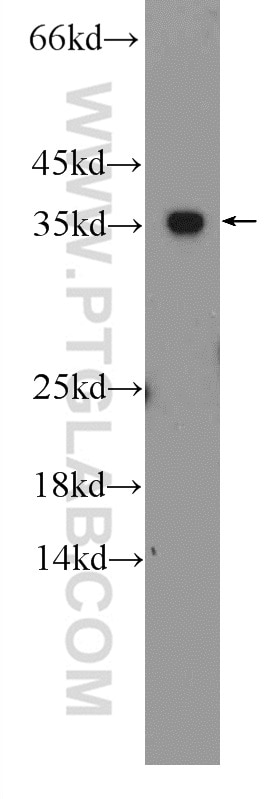 Western Blot (WB) analysis of mouse spleen tissue using GADD45A Polyclonal antibody (13747-1-AP)