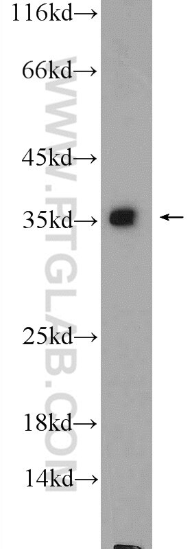 Western Blot (WB) analysis of PC-13 cells using GADD45A Polyclonal antibody (13747-1-AP)