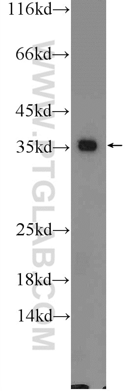 Western Blot (WB) analysis of A549 cells using GADD45A Polyclonal antibody (13747-1-AP)