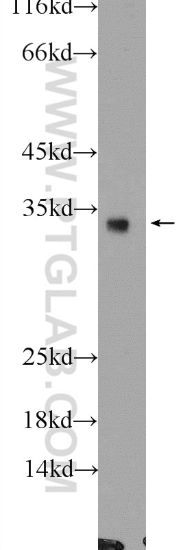 Western Blot (WB) analysis of COLO 320 cells using GADD45A Polyclonal antibody (13747-1-AP)