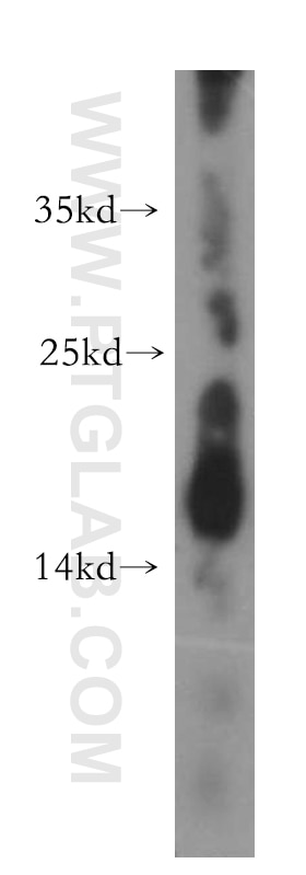 Western Blot (WB) analysis of human placenta tissue using GADD45G Polyclonal antibody (10277-1-AP)