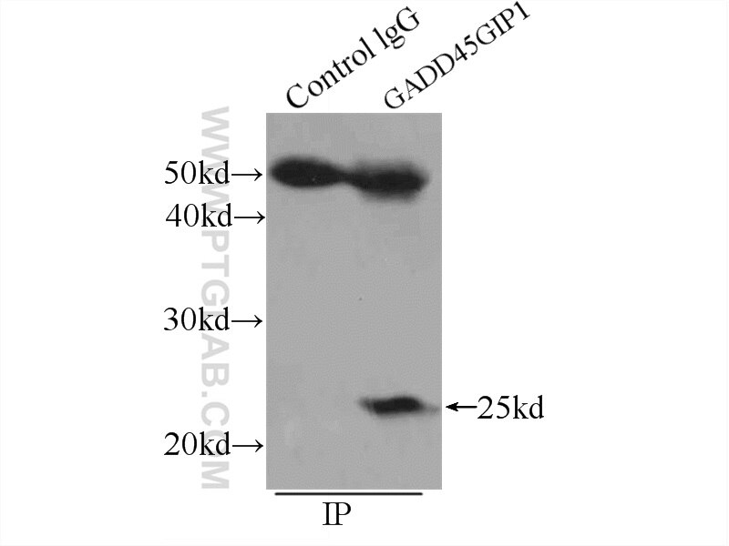 Immunoprecipitation (IP) experiment of mouse heart tissue using GADD45GIP1 Polyclonal antibody (16260-1-AP)