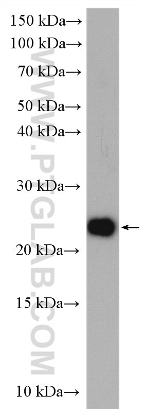 Western Blot (WB) analysis of HEK-293 cells using GADD45GIP1 Polyclonal antibody (16260-1-AP)