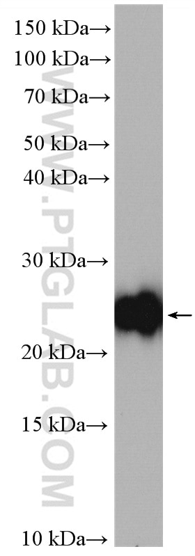 Western Blot (WB) analysis of SKOV-3 cells using GADD45GIP1 Polyclonal antibody (16260-1-AP)