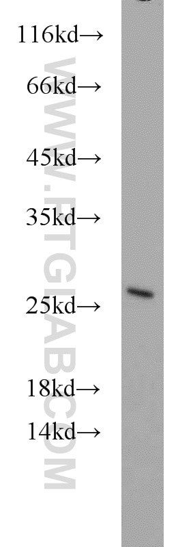 Western Blot (WB) analysis of NIH/3T3 cells using GADD45GIP1 Polyclonal antibody (16260-1-AP)