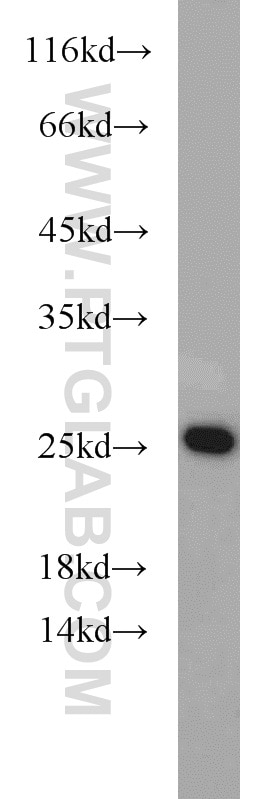 Western Blot (WB) analysis of mouse heart tissue using GADD45GIP1 Polyclonal antibody (16260-1-AP)