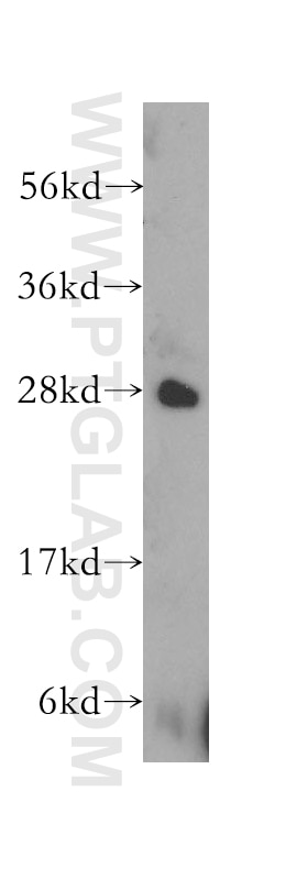 Western Blot (WB) analysis of mouse heart tissue using GADD45GIP1 Polyclonal antibody (16260-1-AP)