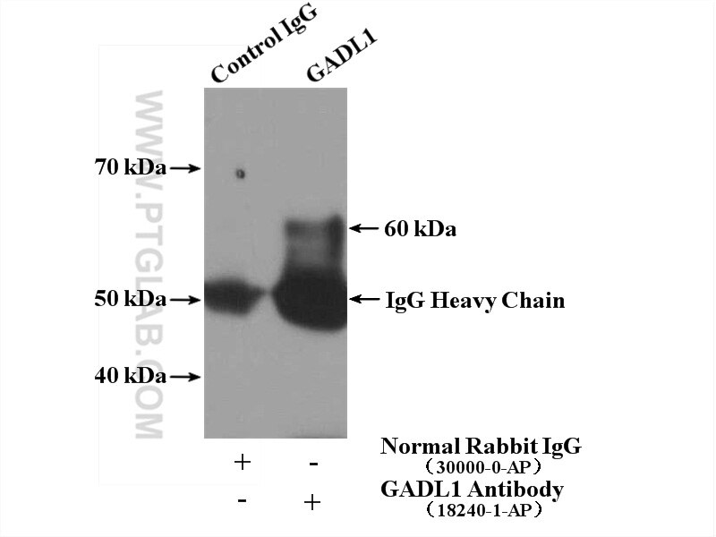 Immunoprecipitation (IP) experiment of mouse brain tissue using GADL1 Polyclonal antibody (18240-1-AP)