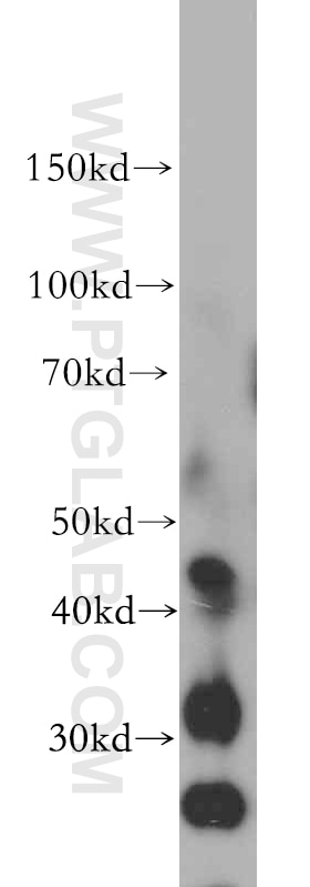 Western Blot (WB) analysis of human brain tissue using GADL1 Polyclonal antibody (18240-1-AP)