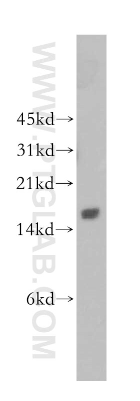 Western Blot (WB) analysis of Jurkat cells using GAGE1 Polyclonal antibody (12795-1-AP)