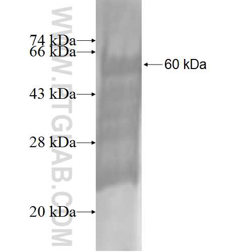 GAGE1 fusion protein Ag3534 SDS-PAGE