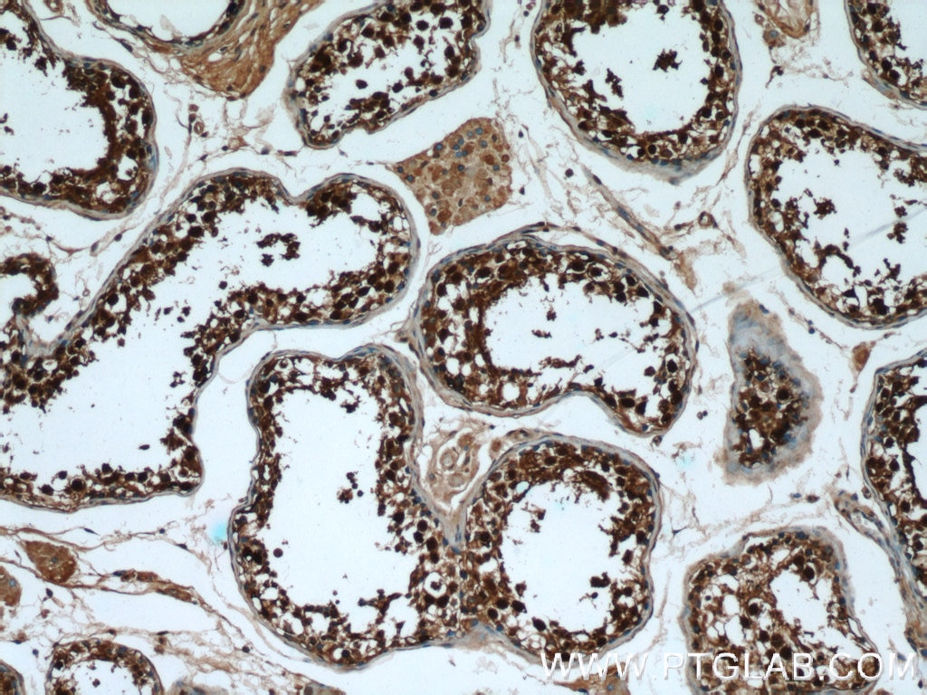 Immunohistochemistry (IHC) staining of human testis tissue using GAGE2D Polyclonal antibody (12532-1-AP)