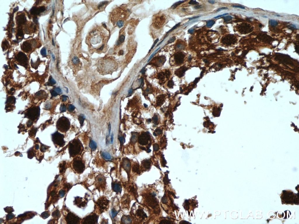 Immunohistochemistry (IHC) staining of human testis tissue using GAGE2D Polyclonal antibody (12532-1-AP)