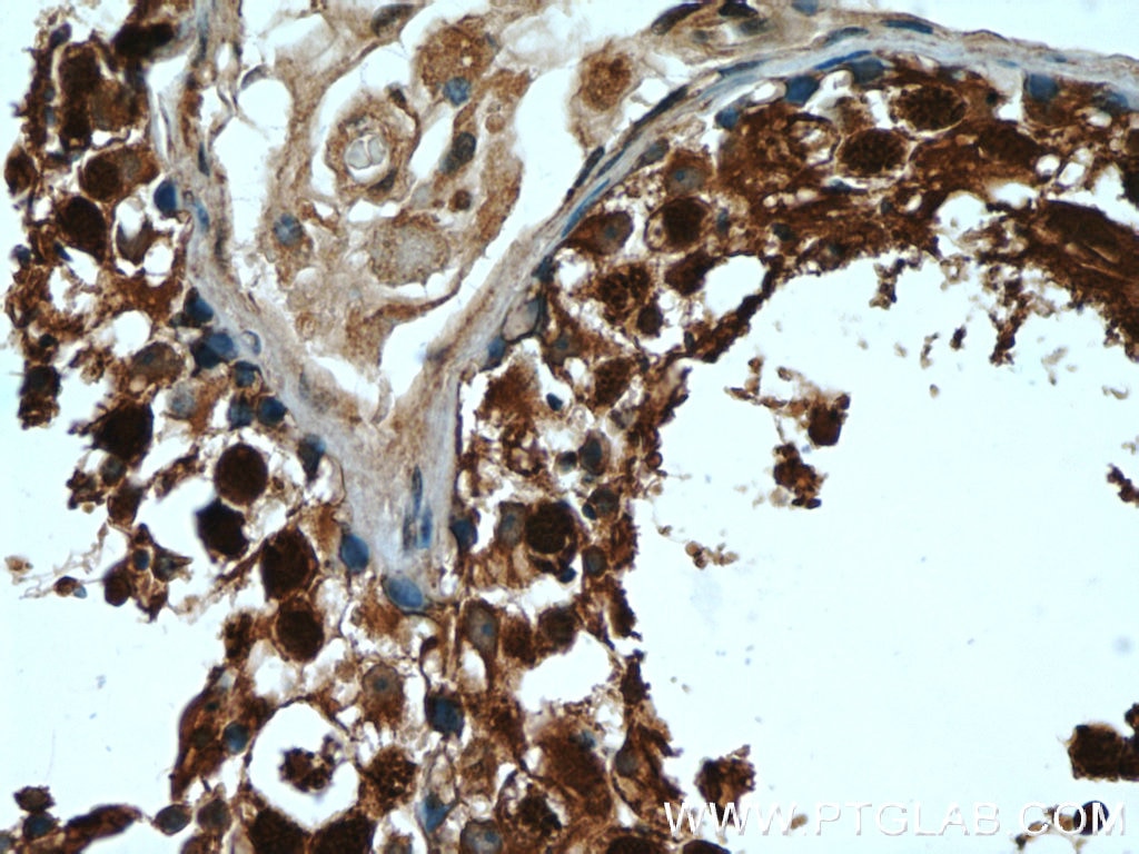 IHC staining of human testis using 12532-1-AP