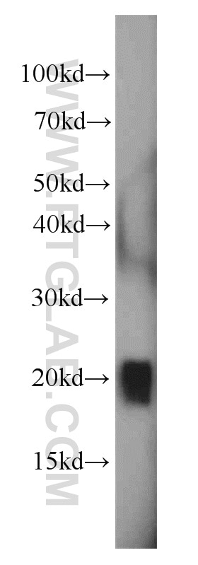 Western Blot (WB) analysis of HeLa cells using GAGE2D Polyclonal antibody (12532-1-AP)