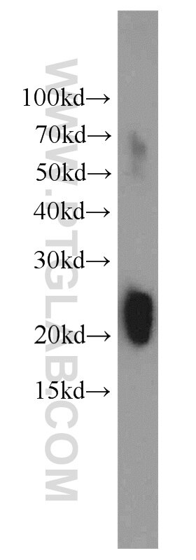 Western Blot (WB) analysis of human testis tissue using GAGE2D Polyclonal antibody (12532-1-AP)