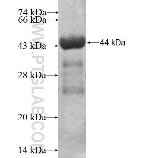 GAGE2D fusion protein Ag3230 SDS-PAGE
