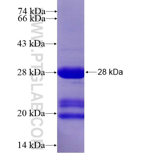 GAGE2A fusion protein Ag12914 SDS-PAGE