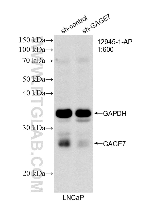 Western Blot (WB) analysis of LNCaP cells using GAGE7 Polyclonal antibody (12945-1-AP)