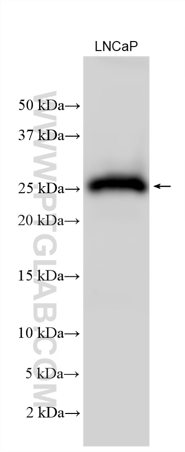 Western Blot (WB) analysis of various lysates using GAGE7 Polyclonal antibody (12945-1-AP)