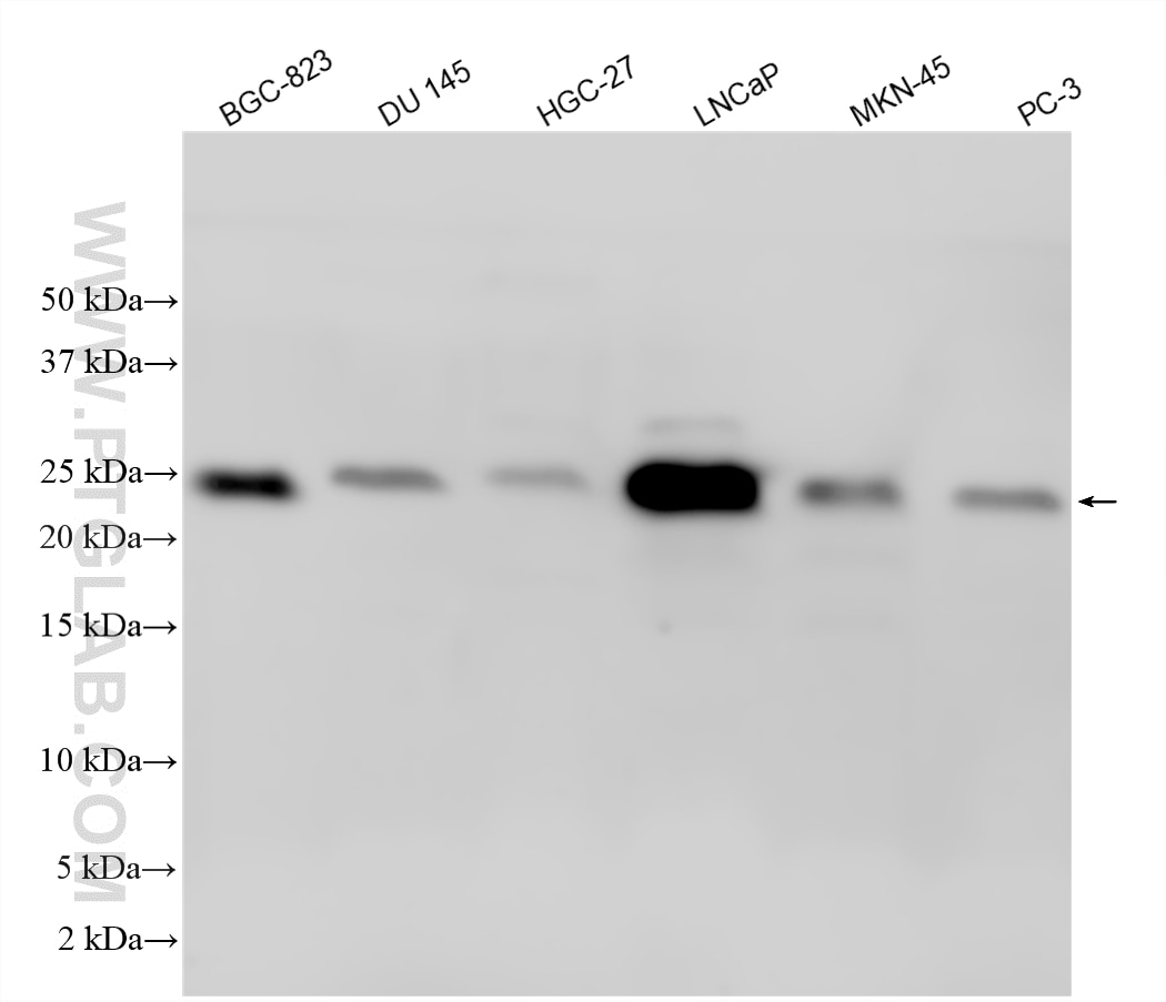 Western Blot (WB) analysis of various lysates using GAGE7 Polyclonal antibody (12945-1-AP)