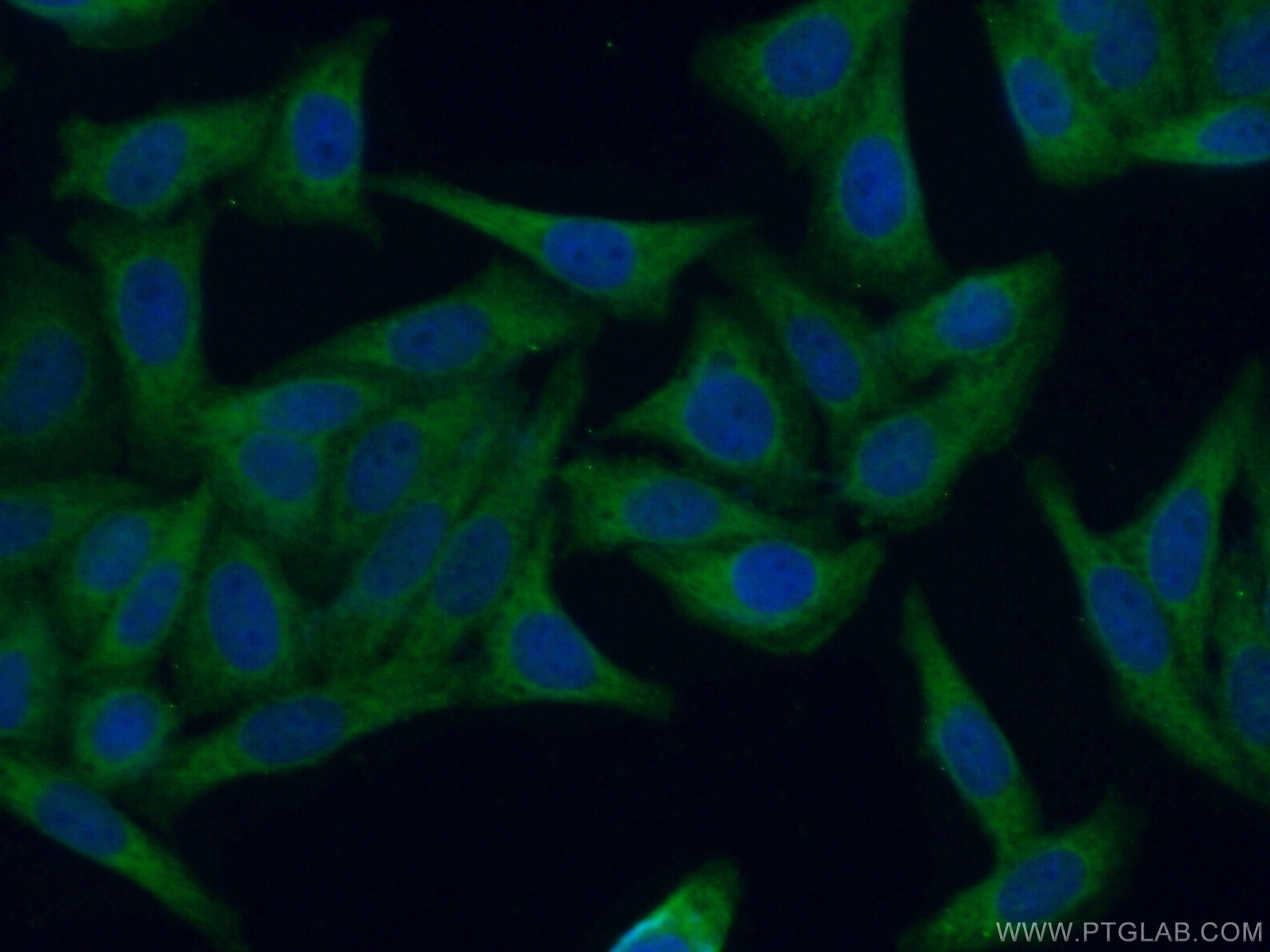Immunofluorescence (IF) / fluorescent staining of HepG2 cells using GAK Polyclonal antibody (12147-1-AP)