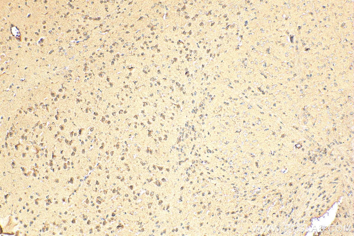 Immunohistochemistry (IHC) staining of mouse brain tissue using GAK Polyclonal antibody (12147-1-AP)