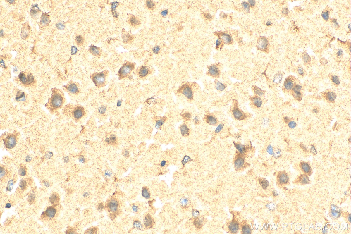 Immunohistochemistry (IHC) staining of mouse brain tissue using GAK Polyclonal antibody (12147-1-AP)