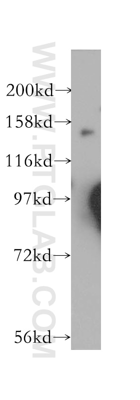 Western Blot (WB) analysis of human brain tissue using GAK Polyclonal antibody (12147-1-AP)