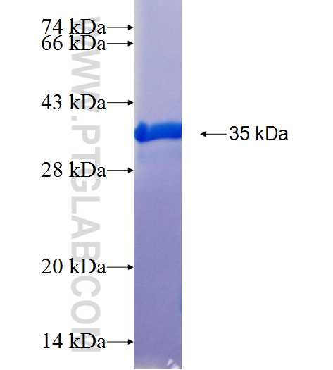GAL fusion protein Ag25645 SDS-PAGE