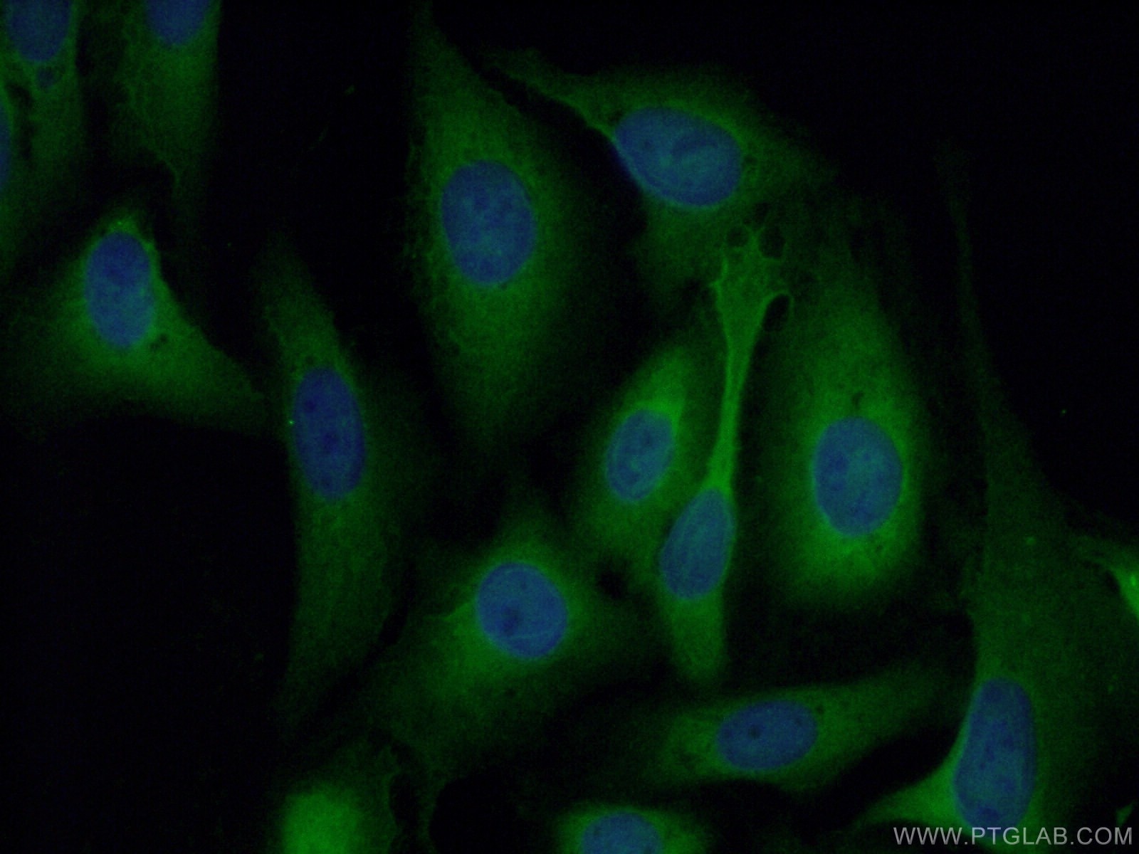 Immunofluorescence (IF) / fluorescent staining of U2OS cells using Galectin-1 Polyclonal antibody (11858-1-AP)