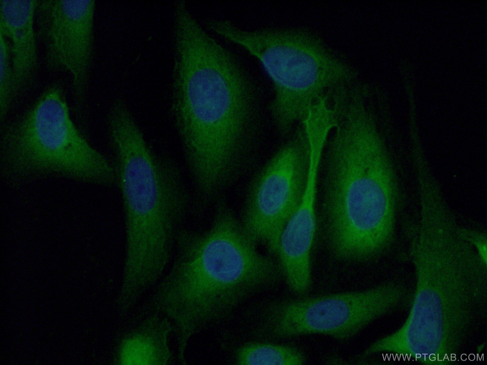 IF Staining of U2OS using 11858-1-AP