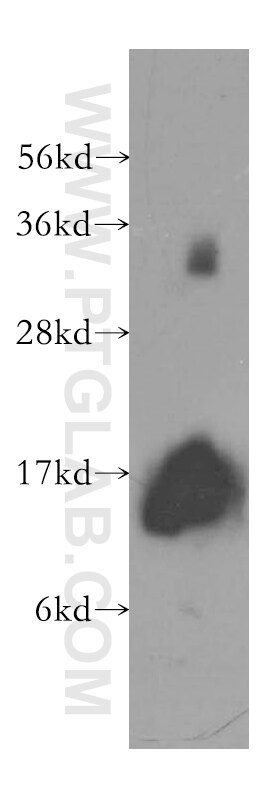 Western Blot (WB) analysis of human heart tissue using Galectin-1 Polyclonal antibody (11858-1-AP)