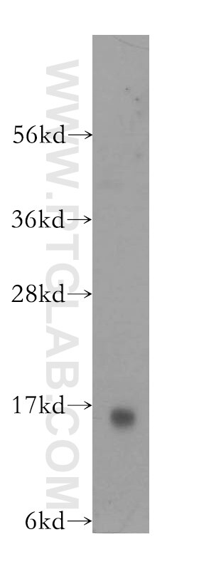 Galectin-1 Polyclonal antibody